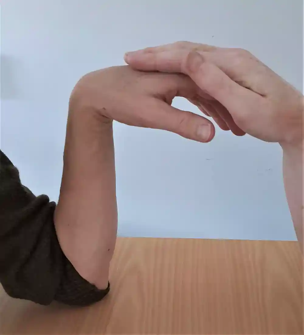 Utförande av Phalens test vänster handled.