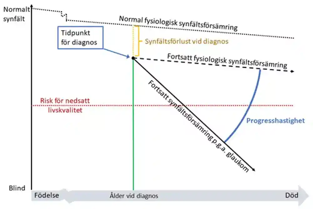 Diagram över synfältsförsämring.